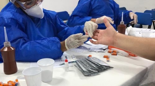 [Câmara realiza testes rápidos para o Coronavírus em funcionários]