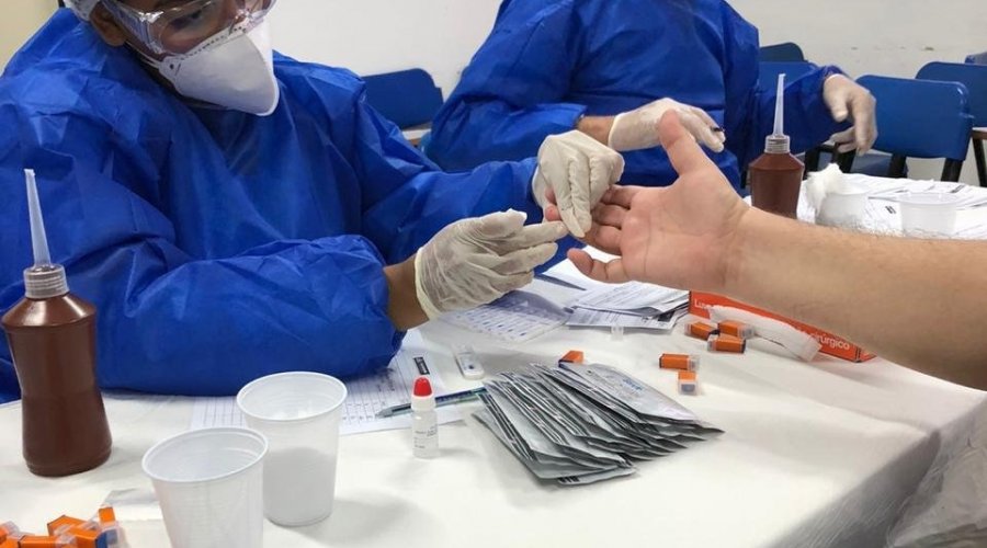 [Câmara realiza testes rápidos para o Coronavírus em funcionários]