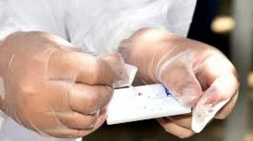 [Estudantes e professores farão teste para o Covid-19 no Subúrbio Ferroviário]