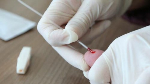[Covid-19: Brasil registra mais 41,7 mil casos e 660 novas mortes em 24h]
