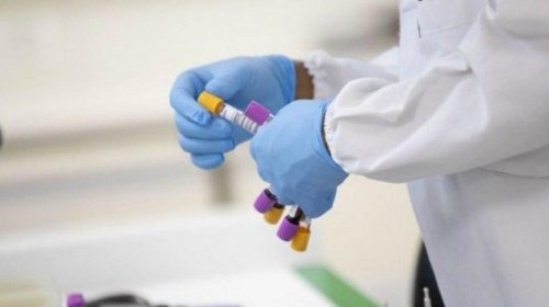 [Ministério da Saúde confirma segundo caso de reinfecção por Covid-19 no Brasil]