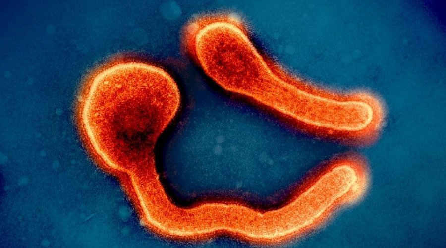[Doença prima do ebola mata 12 em novo surto; entenda o vírus de Marburg]