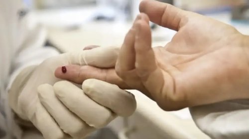 OMS alerta que suspensão de recursos dos EUA pode tornar o HIV uma [OMS alerta que suspensão de recursos dos EUA pode tornar o HIV uma