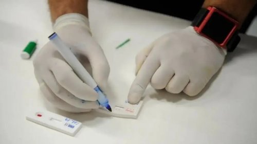 [Bahia registra redução de mortes por hepatites B e C na última década]