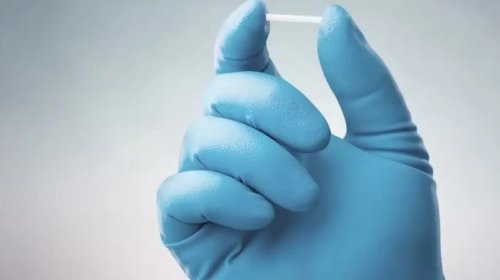 [Planos de saúde terão cobertura obrigatória para implante contraceptivo]