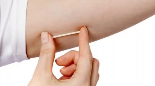 [Anvisa proíbe manipulação e venda de implantes hormonais da Elmeco]