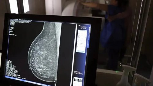 [Câncer de mama é a principal causa de morte por câncer entre mulheres na Bahia]