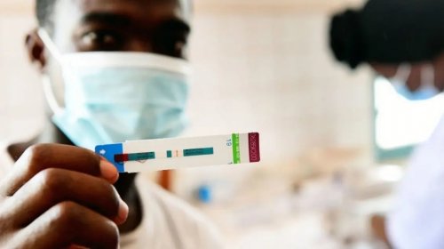 [ONU alerta que redução de investimentos pode agravar avanço do HIV no mundo]